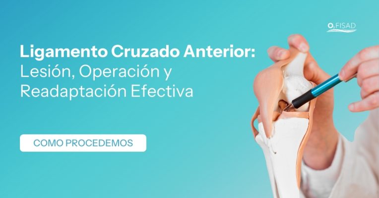 Ligamento Cruzado Anterior O2 Fisad