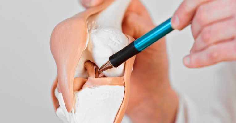 ligamento cruzado anterior